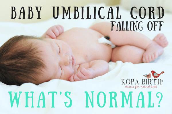 Baby Umbilical Cord Falling Off - What's Normal