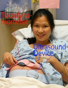 fetal monitoring during labor what to expect