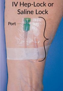 IV hep lock