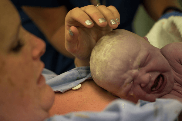 Natural Childbirth vs Epidural - Benefits of Natural Childbirth - Connection
