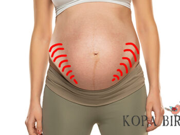 Round Ligament Pain - Best Remedies & Stretches - Image
