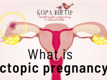 What is Ectopic Pregnancy - image
