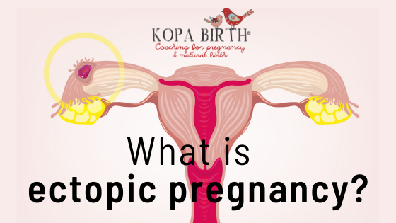 What is Ectopic Pregnancy - image