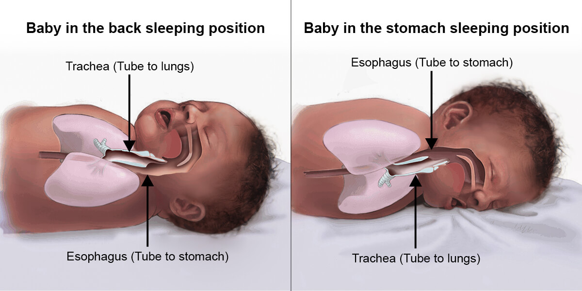 When Can Babies Sleep On Their Stomach - risks of stomach sleeping