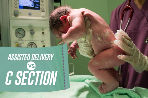assisted delivery vs c section