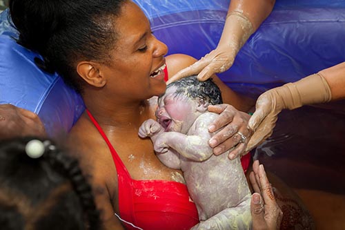 Vernix